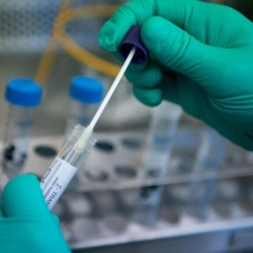 Koronavirüs tahlil bilgisini saklayanlara Laboratuvara soruşturma