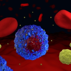 Kanser hastalarına 'CAR-T hücre' müjdesi