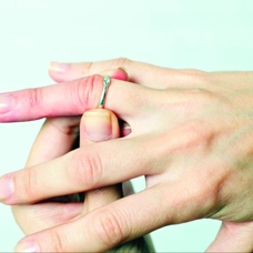 Yüzüğünüz dar geliyor, saatiniz bileğinizi sıkıyorsa! Akromegali hastası olabilirsiz