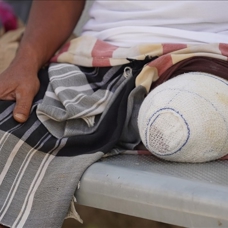 Yemen'de mayınlar ve patlamamış mühimmatlar çocukların hayatını tehdit ediyor