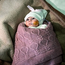 Filistinli 3 günlük bebek şah damarına yapılan müdahaleyle hayata tutundu